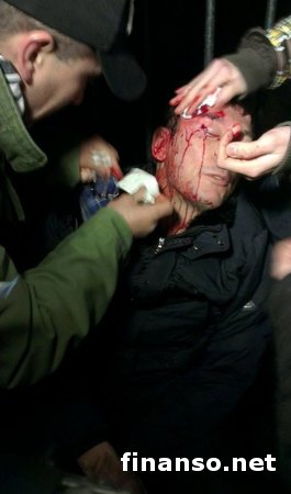 Луценко разбили голову