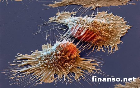 Медикам удалось сфотографировать и изучить раковые клетки – подробности