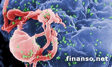 Невероятно, но факт: ученым удалось успешно подавить ВИЧ в человеческом организме