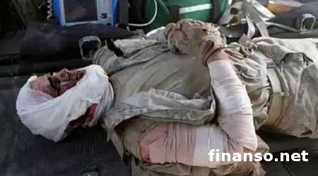 Боевик Гиви получил тяжелое ранение осколком снаряда под Донецком