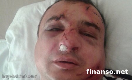 В Киеве сильно избили главаря луганских сепаратистов