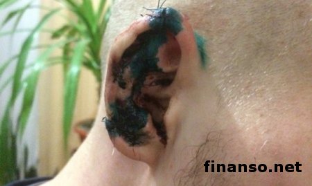 «Тайсон» в ВРУ: оппозиционер откусил ухо лидеру «Азова» в Херсоне