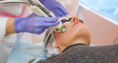 Коагуляция в косметологии