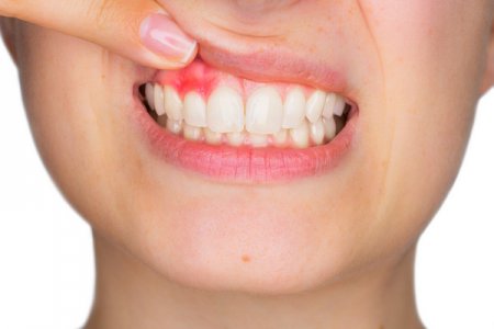 «Стоматология Татьяны Коновой» — 11 направлений для лечения и профилактики ваших зубов, десен