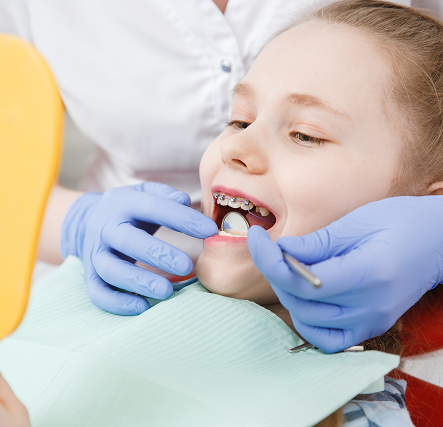 Лечение неровности зубов у детского ортодонта клиники «Стоматология Татьяны Коновой» — 4 вида брекет-систем для детей